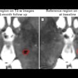 2025 12 16 Radiology Mrgfus Brain Thumbnail