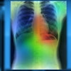 Artificial Intelligence Lung Color Res