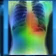 Artificial Intelligence Lung Color Res