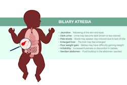 Biliary Atresia Disease Adobe Pikovit