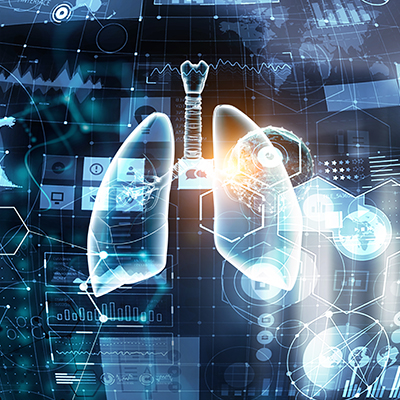 Lung Technology Medicine 400