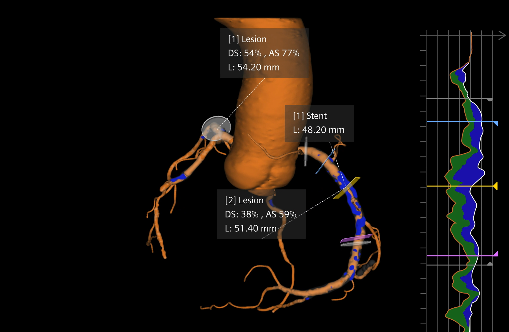 Siemens Healthineers Syngoct C Cockpit aap Zps Jiq Q