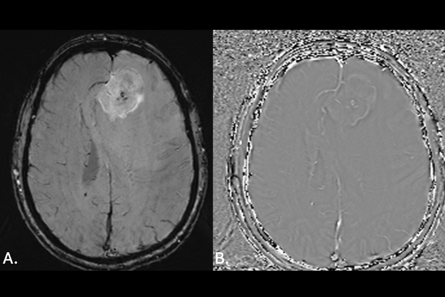 2026 01 22 Fig 5 Mri Insider Thumbnail
