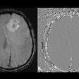2026 01 22 Fig 5 Mri Insider Thumbnail