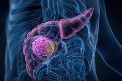 Pancreas Cancerous Area 3 D Rendering Adobe Anton