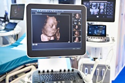 Ultrasound 3 D Fetal Head