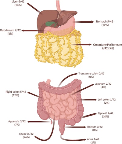 Localizations of fishbones in the French Guiana study.