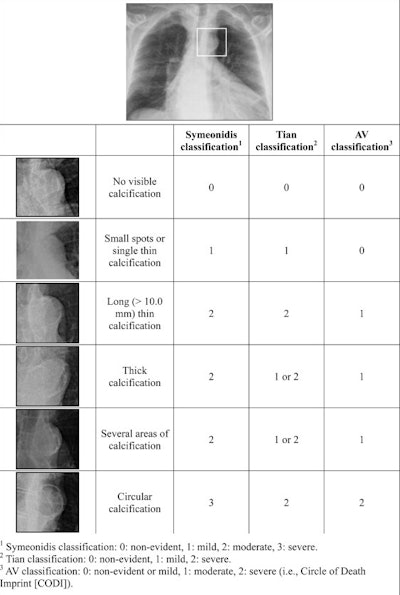 Grading of radiological findings of aortic calcifications according to the earlier described Symeonidis and Tian classification systems and the novel AV classification system. 1 Symeonidis classification: 0: non-evident, 1: mild, 2: moderate, 3: severe. 2 Tian classification: 0: non-evident, 1: mild, 2: severe. 3 AV classification: 0: non-evident or mild, 1: moderate, 2: severe.