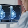 Mammogram Dense Breasts Cropped