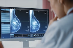Mammogram Dense Breasts Cropped