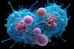 Ovarian Cancer Cells Adobe Justlight