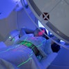 Radiation Therapy