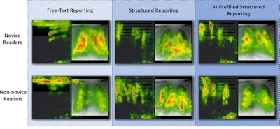 Heatmap overlays of fixations on the viewer display as a function of reader experience level and reporting mode. Each panel shows combined fixation heatmaps for all readers in each group. Within each panel, the radiograph display field is located on the right, and the corresponding report display field is on the left. The heatmaps illustrate the spatial distribution of cumulative fixation durations, with green indicating lower fixation intensity and red indicating higher fixation intensity. Color scaling was applied individually to each heatmap, meaning that fixation intensities are not directly comparable across panels. Heatmaps were generated in the postprocessing stage using Tobii Studio. With structured reporting and AI-prefilled structured reporting, readers’ visual attention was particularly focused on the key anatomic regions queried by the structured template. As a result, gaze was centered on the central and basal lung fields, whereas the lung apices and extrapulmonary or extracardiac structures received less attention.