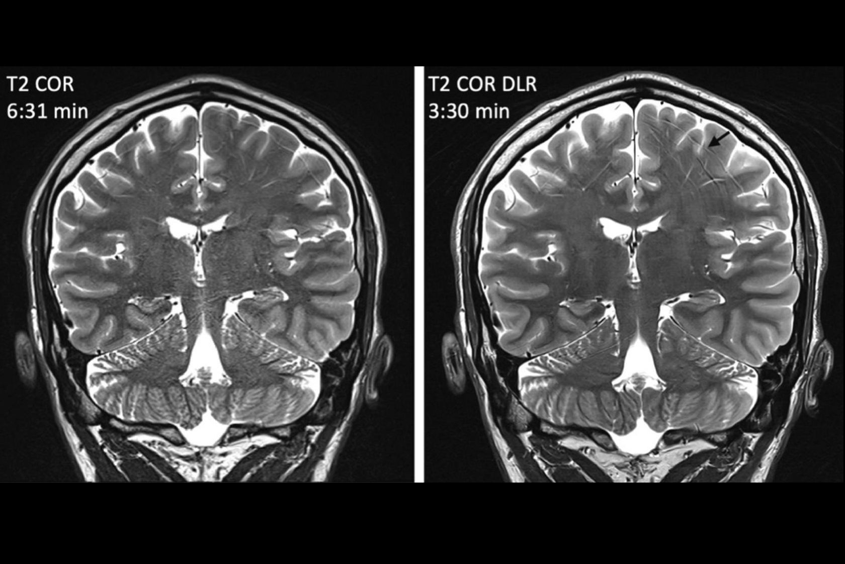 2026 03 02 Ame T2 Dl Fig3 Thumbnail