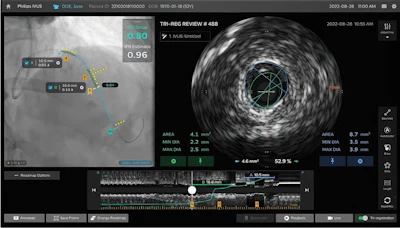 Philips IntraSight Plus screen.