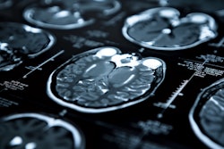 Mri Scan Neurological