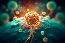 Prostate Cancer Rendering