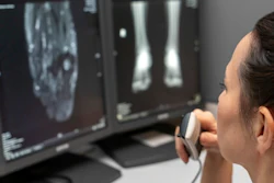 Radiologist Xray Foot 400