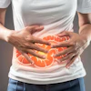 Inflammatory Bowel Crohns