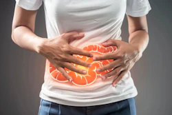 Inflammatory Bowel Crohns