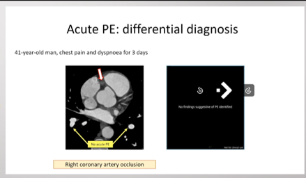 Lederlin 1 Thumbnail