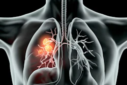 Lungs