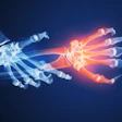 Hand Xrays