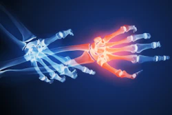 Hand Xrays