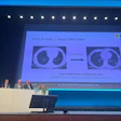 Frühstadiumbefunde sind nicht immer eindeutig, multidisziplinäres Urteilsvermögen ist keine Formalität.' machte die Knötchenkonferenz am Ende der Highlight-Sitzung „Wir gegen Lungenkrebs', RöKo 2026, Leipzig, deutlich.