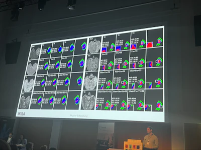 David Rutkevich from the Institute for Artificial Intelligence in Medicine presented a critical perspective on AI in radiology, titled 'Ciao MTR -- welcome AI?'