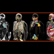 Siemens Healthineers Press Ai Contouring