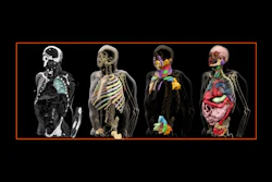 Siemens Healthineers Press Ai Contouring