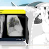 An AI system highlights multiple abnormalities on a chest radiograph, including a pulmonary nodule (nódulo pulmonar), pleural effusion (derrame pleural), and alveolar syndrome/consolidation (síndrome alveolar).