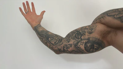 How precisely do black tattoos affect x-rays? The researchers tackled this tricky question.