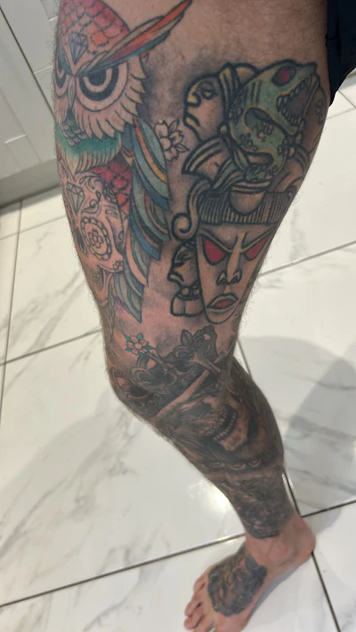 Growing social acceptance of tattoos means more patients now present with them.