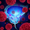 Am 2016 10 04 11 38 34 158 Prostate 400