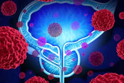 Am 2016 10 04 11 38 34 158 Prostate 400