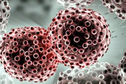 Am 2020 06 26 16 29 2945 Cancer Lung 400
