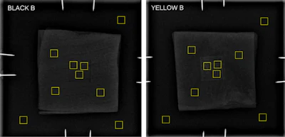 Representative radiographs of black (left) and yellow (right) tattoo pigment samples demonstrating standardized regions of interest (ROIs) used for contrast-to-noise ratio (CNR) analysis. Presented by the Exeter team at UKIO 2026 and ECR 2026 (see https://epos.myesr.org/poster/esr/ecr2026/C-29619).