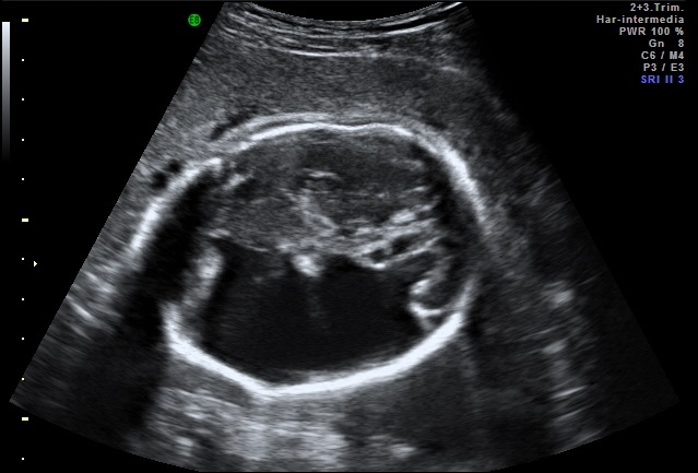 Image2