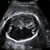 Image2