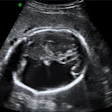 Image2