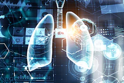 Lung Technology Medicine 400