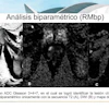 Biparametric prostate MRI identified clinically significant Gleason 3+4 prostate cancer using T2-weighted imaging, diffusion-weighted imaging, and ADC mapping alone.