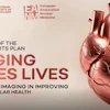 The Safe Hearts Plan aims to shift healthcare systems toward prevention, earlier diagnosis, and more personalized care.