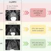A visual abstract of the study.
