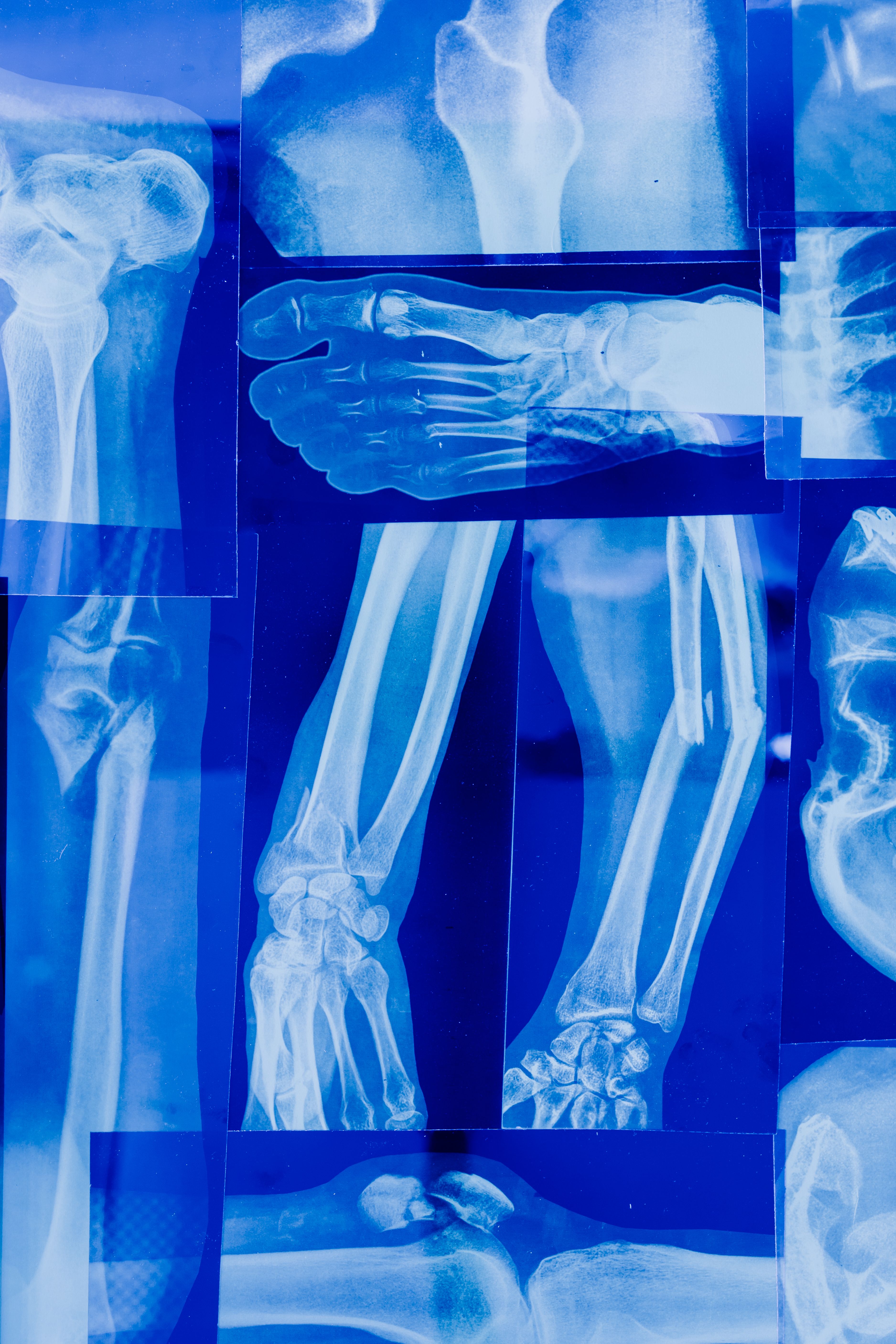 Illustration of musculoskeletal x-ray imaging. New European guidance aims to harmonize imaging protocols for osteosarcoma and Ewing sarcoma.