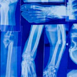 Illustration of musculoskeletal x-ray imaging. New European guidance aims to harmonize imaging protocols for osteosarcoma and Ewing sarcoma.