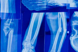 Illustration of musculoskeletal x-ray imaging. New European guidance aims to harmonize imaging protocols for osteosarcoma and Ewing sarcoma.