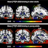 F-18 PI-2620 average binding potential maps. Mean tracer binding (DVR) image from 165 older adults (A) and 13 young adults (B). Images are scaled from 1 to 1.8 for display purposes, but DVR values of less than 1 were frequently observed.